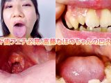 ガチャ歯フェチ必見！高藤なほのちゃんの口内観察